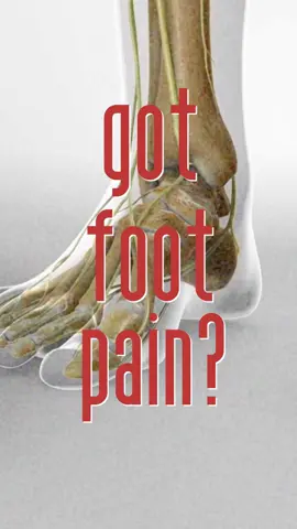 Foot pain can often be caused by nerve-related issues such as Morton's neuroma or tarsal tunnel syndrome. #morton #footpain #medicaleducation #medicalanimation #3danimation #3dmedicaleducation #3danimationsurgery