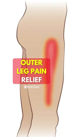 One Move for Quick Outer Leg Pain Relief #legpain #legpainrelief #outerlegpain 