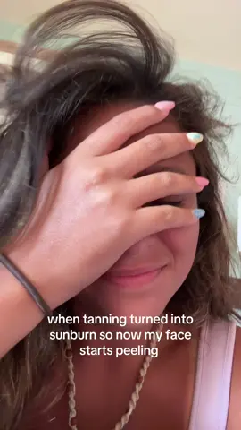 why cant i just tan? #fyp #blowthisup #funny #relatable 