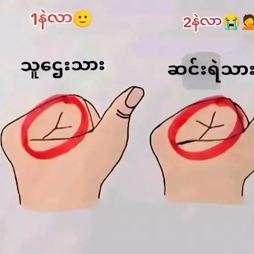 ဆငိးရဲပါတယ်ဗျာ