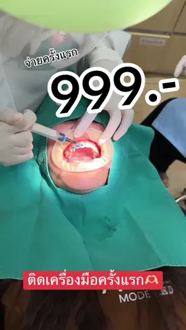 ฟันสวยได้ง่ายๆแค่ 999.-  รับของแถมมูลค่า 14,900.-  #teethtalkdentalclinic #ทําฟัน #ยิ้มสดใส #จัดฟันครั้งแรก 