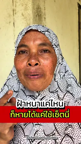 ฝ้าหนาแค่ไหน ก็หายได้แค่ใช้เซตนี้##madamlin##ขมิ้นจันทร์หอมในตํานาน