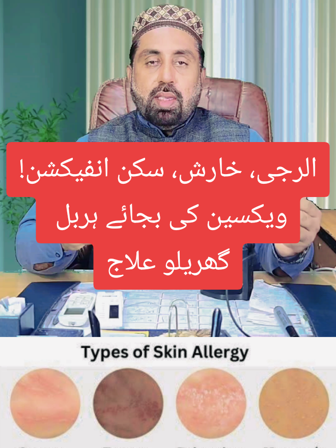 #SkinAllergy #KharishKaIlaj #SkinInfection #AllergyRelief   #HerbalRemedy #NaturalCure #HomeRemedy #DesiTotka   #ItchingTreatment #SkinRash #AyurvedicTips #SehatmandZindagi   #TotkaForItching #GharKaIlaj #AntiAllergyTips   #HerbalSolution #TikTokHealth #HealthTips #viralvideo #fyp 