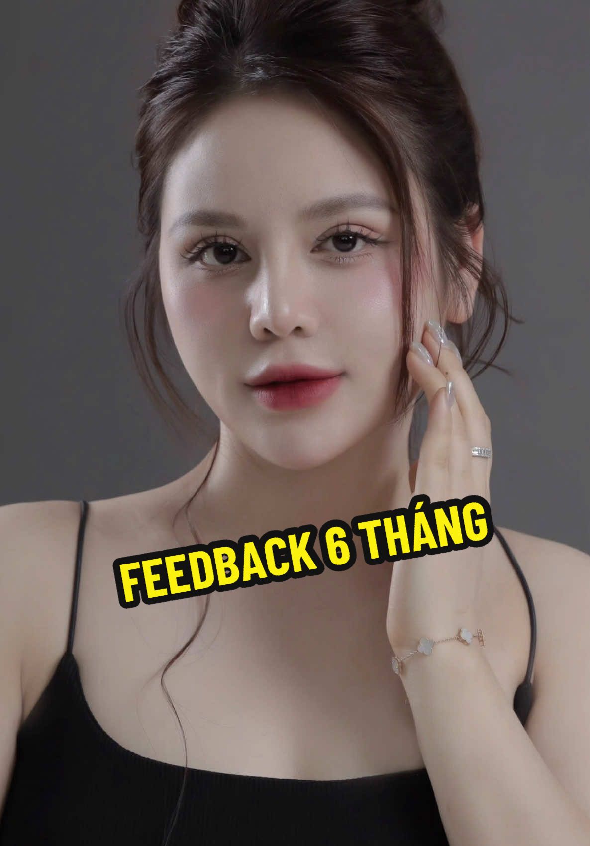 Nếp mí mượt như này có phải Guu của các chị không? #ThuyLeClinic #PhongKhamThuyLe #CatMiTuNhien #PhauThuatAnToan #ComboMatToTron 