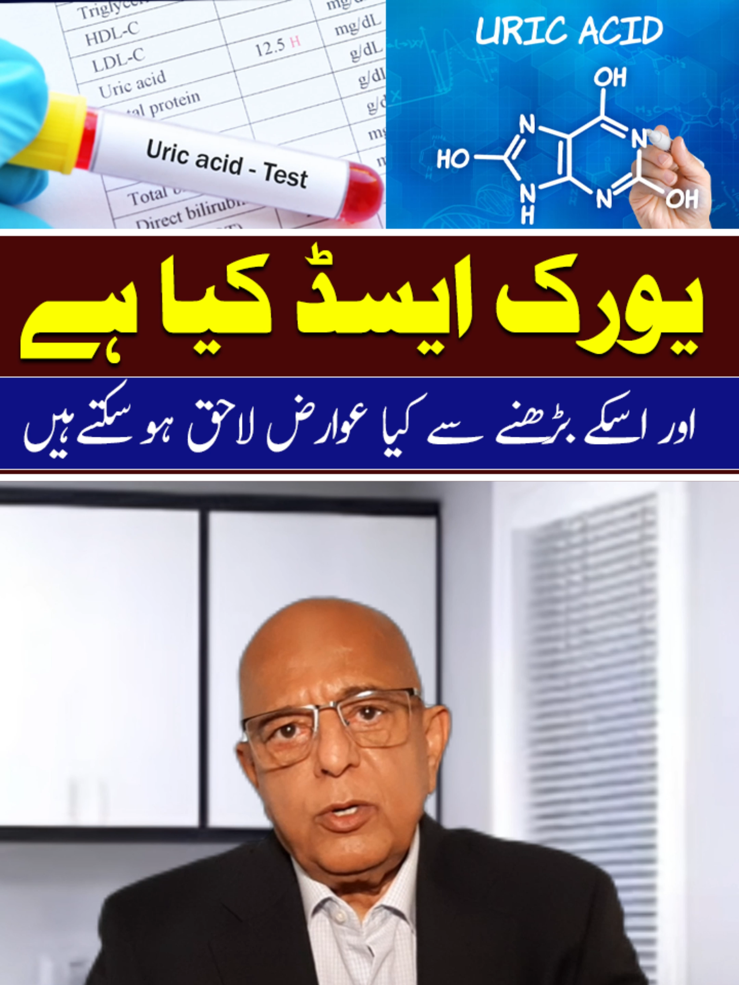 Uric Acid Kya Hai? High Uric Acid Ke Nuksanat | By @drjeelani  #UricAcid #HighUricAcid #SehatKiBaat #drjeelanii #GathiyaKaIlaj #UricAcidSymptoms #KidneyHealth #JoronKaDard #HealthTipsUrdu #TikTokSehat #NaturalCure #UrduHealthVideo #HealthAwareness #UricAcidTest #TikTokDoctors