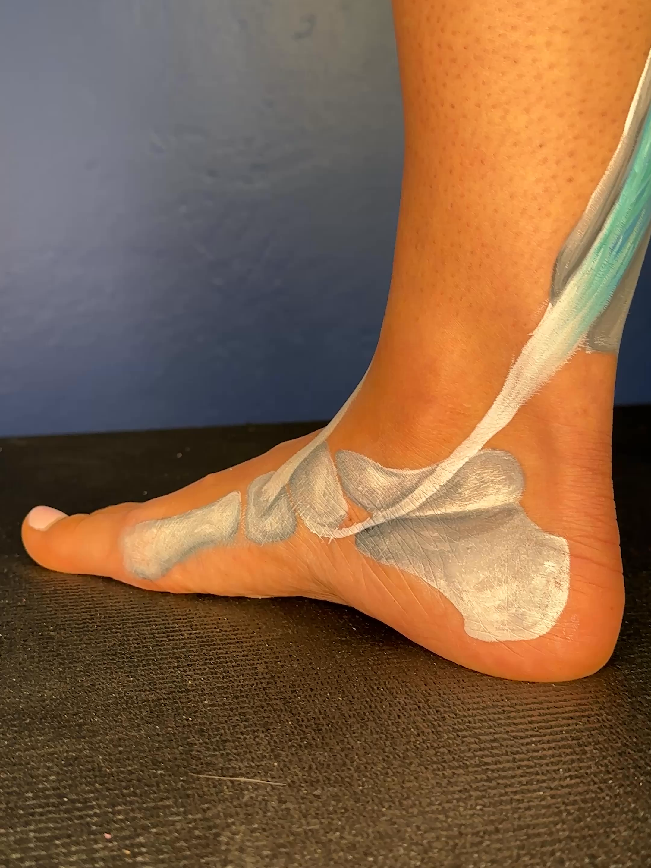 🔥 Plantar fasciitis pain? Let’s fix that fire under your foot. Plantar fasciitis kicks in when your arch flattens out too much and overstretches the bottom of the foot, putting constant tension on the plantar fascia—like yanking a rubber band all day. The fix? Not just stretching.  You need to strengthen the muscles that hold that arch UP. 🎯 Focus on:  👉 Tibialis posterior  👉 Foot intrinsics (the deep stuff inside your foot that keeps it stable) Here’s your move:   Short Foot Exercise  ✅ Sit or stand  ✅ Draw your big toe toward your heel without curling it  ✅ Feel that arch lift? That’s your foot waking up and fighting back   This move eases pressure off the fascia and gives it the slack it needs to calm down and heal. More arch strength = less pain.  It’s that simple. 🔗 Start fixing it from the ground up at MoveU.com  Fix yo feet. Fix yo pain. #FixYoShit #MoveU #PlantarFasciitis #FootPain #ArchSupport #ShortFootExercise
