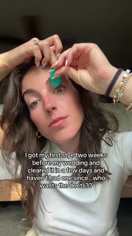 stress can do it but so can dirty eyes 👀 #styes #stye #styeeye #eyecaretips #eyetok 