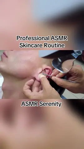 Pimple popping is pure satisfaction #asmr #skincare #unintentionalasmr #barber #barbershop #skincaretips #skincareroutines #english #pimples 