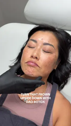 No More 😠 When You’re Feeling 🙂 #dao #daobotox #frownface #botox  @Kelly Morgan @Meems | mom+wife life humor 