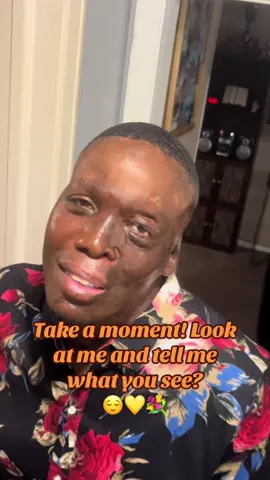 I truly feel good about this. #selflove #scarsmatter #fypage #jesussaves #viralvideo 