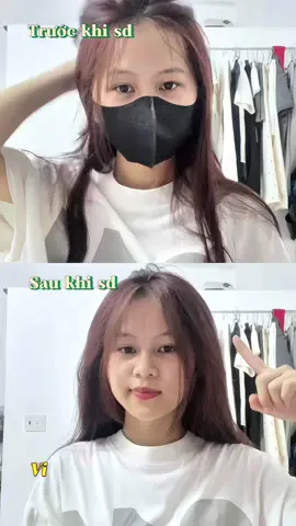 Mấy bà da đầu nhiều dầu thủ ngay 1 em cho tuôiii#happyhairday #kiemdau #lotion#xh #fyp 