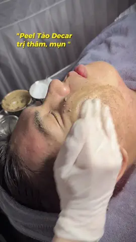 Peel tảo decar, dòng Peel được nhiều chủ Spa ứng dụng trong điều trị mụn thâm #chemicalpeel #xuhuong2025 #kbeautyspa  