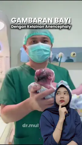 Ini gambaran kelainan Anencephaly.. #edukasi #edukasianak #anenchepaly #kelainan #asamfolat 