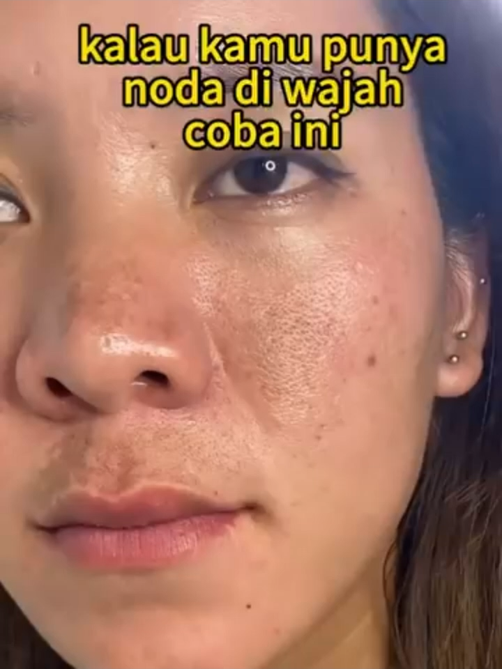 🔥 LEMBAP SEHARIAN TANPA MINYAK!! Hanya 99Rb saja sudah dapat 2 botol!!!