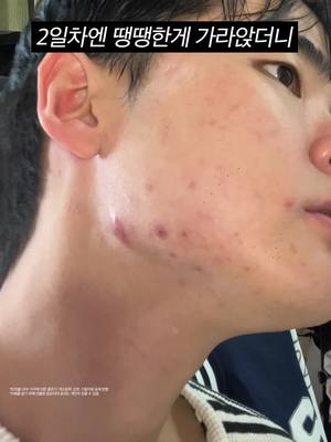 아니 이게 되네;; 턱이랑 볼 부분 ㄹㅈㄷ 드러웠는데 지금 ㄹㅇ깨끗해짐;;