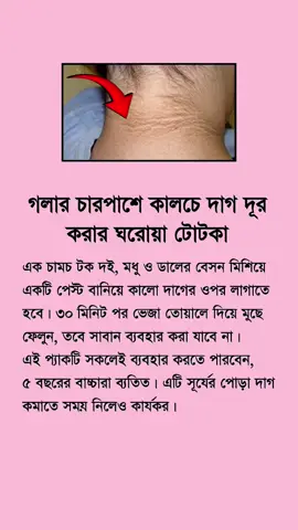 গলার চারপাশে কালচে দাগ কেন পড়ে⁉️#foryou #highlight #viralvideo #everyone 