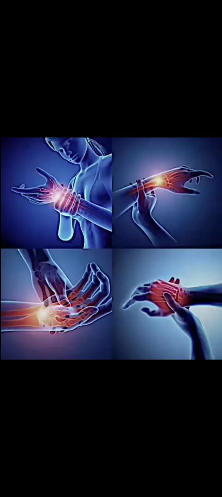 #foryou 