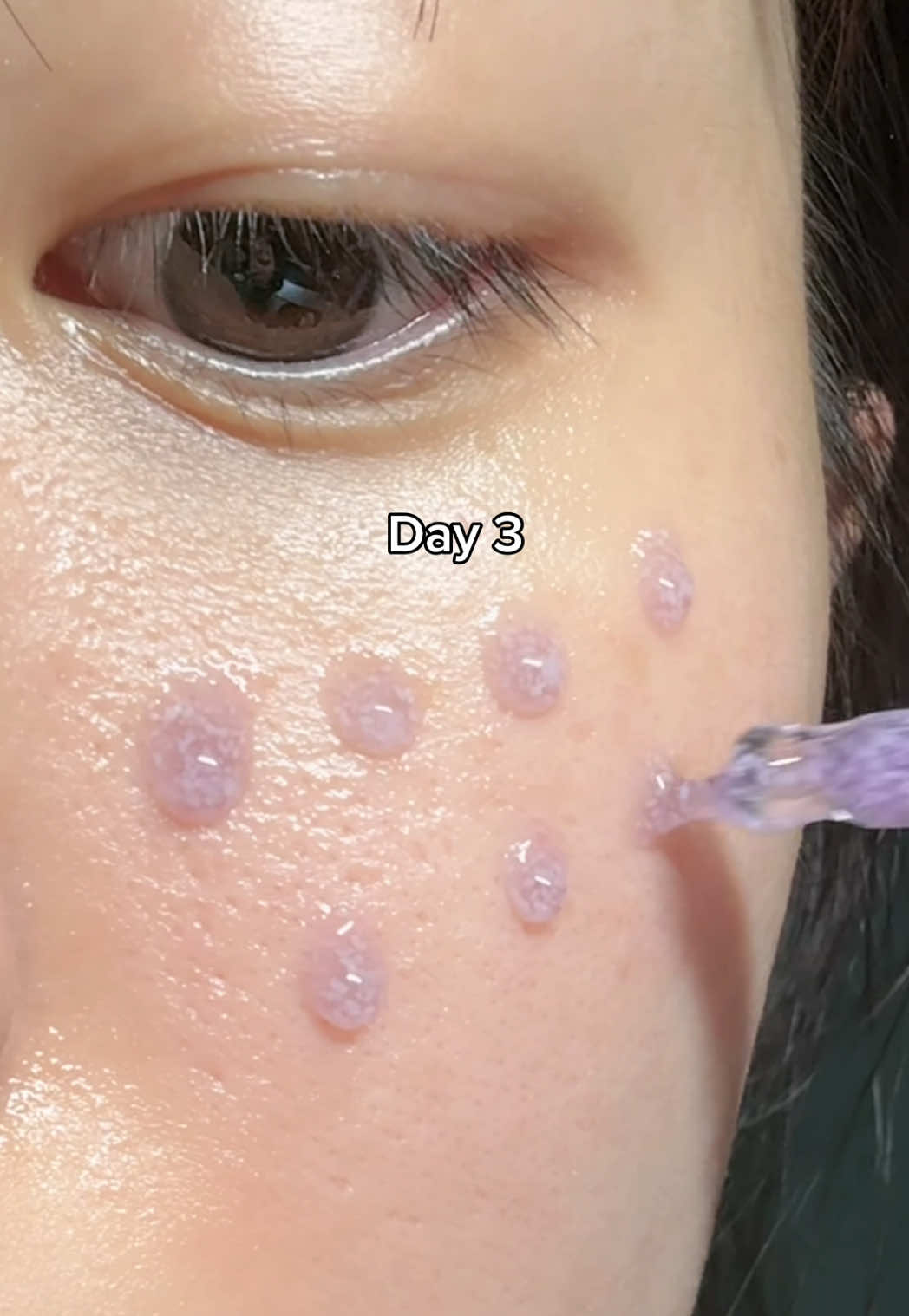 Bakuchiol=your pore minimizer💜 #pores #bakuchiol #bakuchiolserum #retinol #retinolforbeginners #poreminimizer #koreanskincare #glassskin #fyp @Eqqualberry 