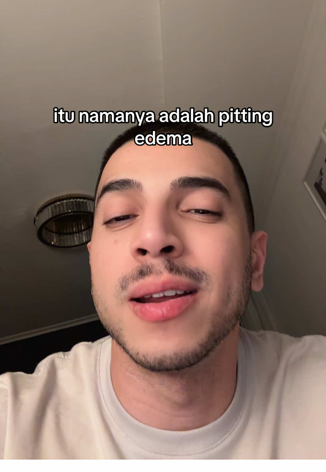 #stitch with @jiaaa🧚‍♀️🫧 pitting edema