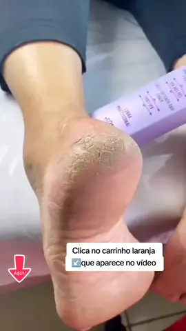 #LixadorDePé #PéPerfeito #PedicureEmCasa #CuidadosComOsPés #PéDePrincesa #TiraCalos #AutoCuidado #EsfoliadorElétrico #LixaDePé #PéMacio #DicasDeBeleza #AchadinhosTikTok #ViralNaTikTok #TikTokShopBrasil #BelezaEmCasa #tiktokshopchegou  @Achadinhos TikTok Shop BR** @Achadinhos TikTok Shop BR** @Achadinhos TikTok Shop BR** 