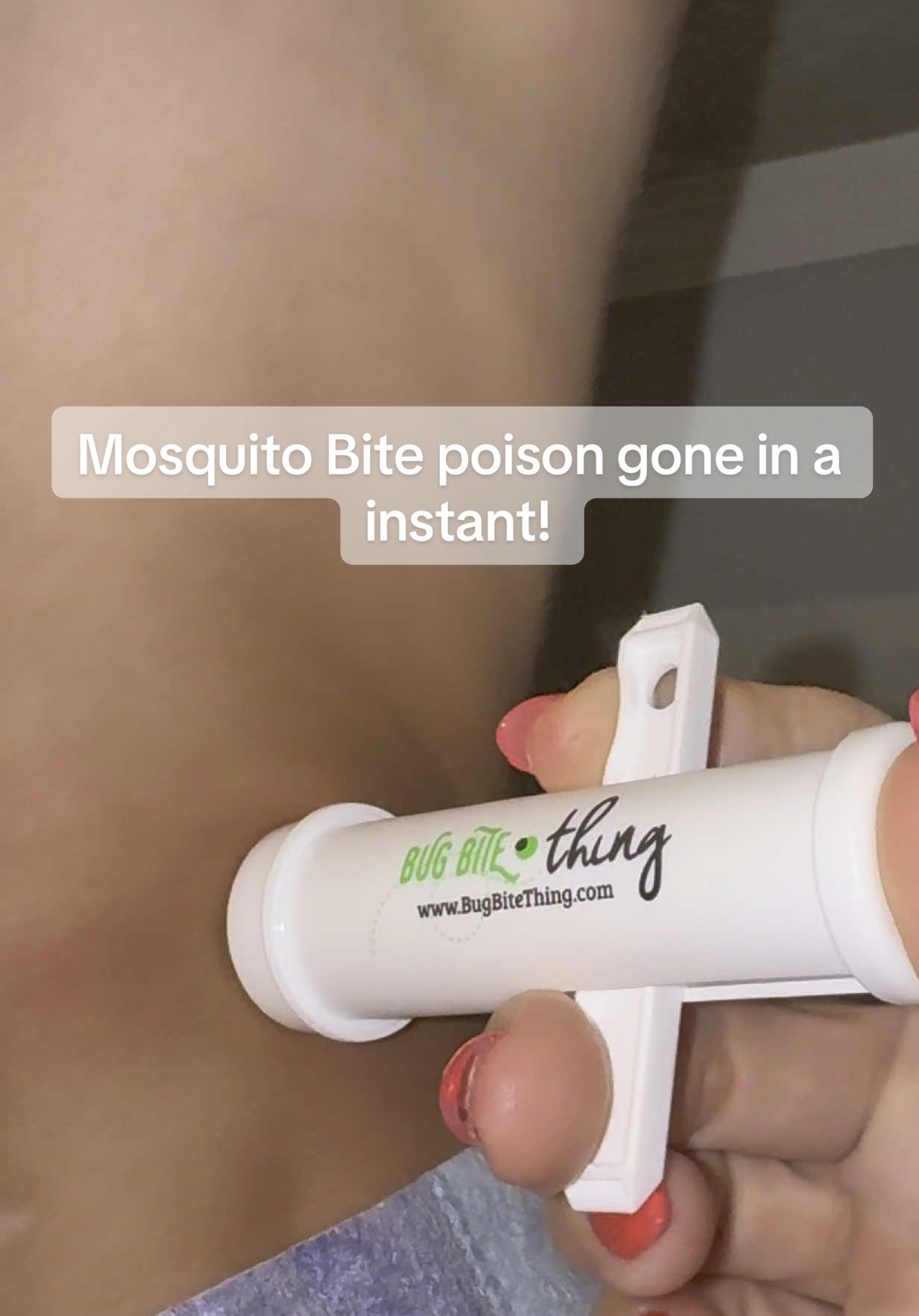 I finally was able to get it on video but I love this gadget! It actually works! #bugbitething #nomoremosquitobites #bugbites #bugbitethingsuctiontool #dealsforyoudays #midyearsale #summersales #tiktokshop #dealsforyoudaysproduct #fyp 