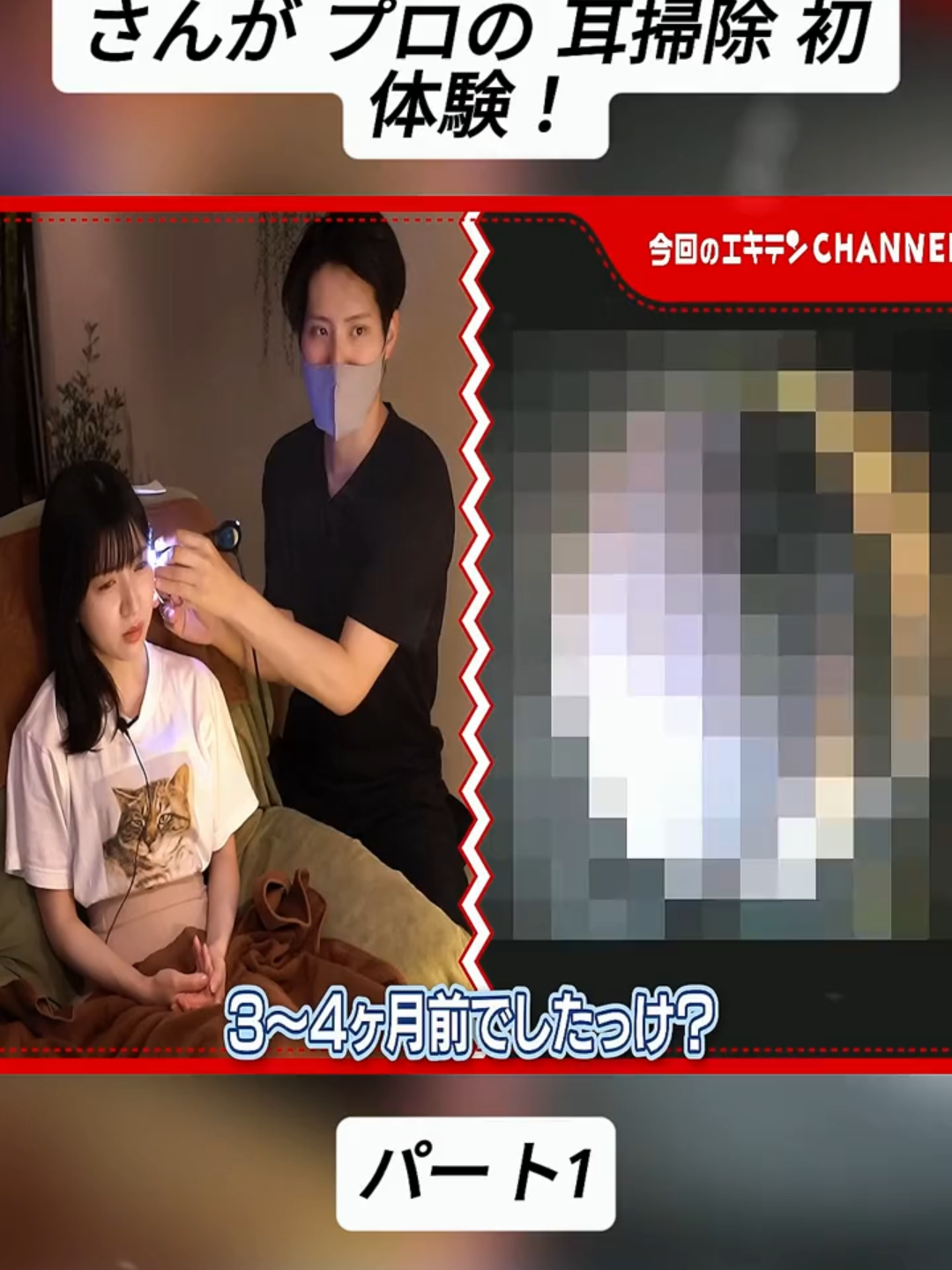 外耳炎でお悩みのみつかさんが プロの 耳掃除 初体験！ パート1 #耳そうじ #プロ #耳かき #Earcleaning #fyp #for #stitch