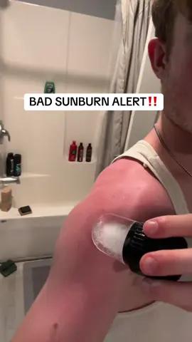 If you want one I left a link! #iceface #fyp #sunburn 