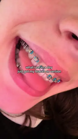 my teeth hurt 😔 #braces #dental #oral #whatieatinaday #wieiad #fyp #foryoupage #viral 
