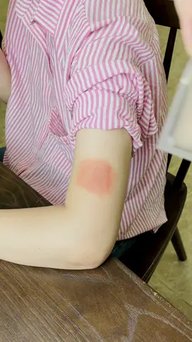 Tay con gái mà có sẹo nhìn hết muốn yêu luôn…