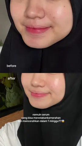 best try akuu bulan ini🫰🏻