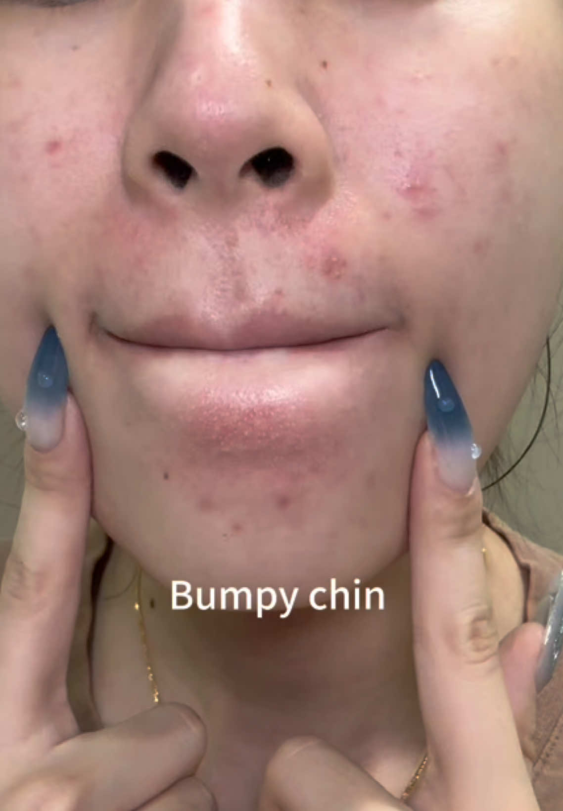 time to clean your pores !!  #drleo #claymask #drleoclaymask #claymaskviral #whitehead #blackheads   @Dr.Leo Skincare Malaysia @Dr.Leo USA 