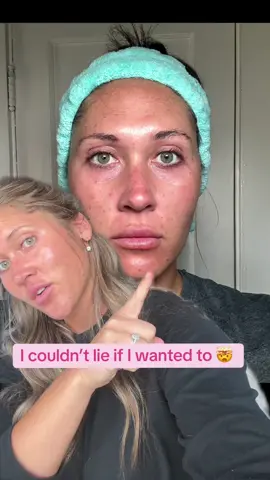 I’m still amazed. 10 days -and my skin has NEVER looked this good. #fyp #esthetician #drmelaxin #mom #trending #mua #828 #skin #glow #glassskin #greenscreen 