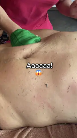 Acompáñenme a ver esta triste historia y descubre cómo decirle adiós a la #pielopaca y darle 
 la bienvenida a una #piel fresca, suave y renovada.
 💆 Porque no solo es un ritual de cuidado, es un momento para reencontrarte contigo 
 mismo.
 📍Visítanos en Nadiya Spa y regálale a tu piel la renovación que merece. .
 #exfoliacioncorporal #nuevapiel #renuevate #cuidatucuerpo  #wellness #momentoparati #cuidadofacial #spalima