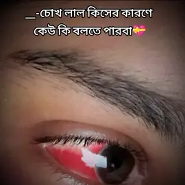 চোখ লাল কিসে,,,  পিরিতির বিষে  নাকি অন্তরে ................. ।।।।,🤐💝#byzid138 #Byzid #prince_byzid #fyp 