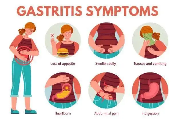 Gastritis (Basic Facts)Gastritis (Basic Facts) Gastritis is inflammation of the stomach lining, which can be acute (sudden) or chronic (long-term). It can result from various causes and may lead to discomfort, pain, and digestive issues. Common Causes of Gastritis: 1. Helicobacter pylori (H. pylori) infection: A major cause of chronic gastritis. 2. Excessive use of NSAIDs (e.g., ibuprofen, aspirin): Can irritate the stomach lining. 3. Alcohol abuse: Damages the protective stomach lining. 4. Stress: Severe stress (e.g., from surgery, burns, or trauma) can trigger acute gastritis. 5. Autoimmune disorders: The immune system attacks stomach cells (less common). 6. Bile reflux: Backflow of bile into the stomach. 7. Other infections (viral or bacterial), smoking, and spicy/fried foods may worsen symptoms. Symptoms: 1. Stomach pain or burning (especially when empty) 2. Nausea/vomiting 3. Bloating or indigestion 4. Loss of appetite 5. Black stools (if bleeding occurs, indicating erosive gastritis) Diagnosis for Gastritis: 1. Endoscopy (with biopsy if needed) 2. H. pylori testing (blood, stool, or breath test) 3. Blood tests (to check for anemia or autoimmune causes) Treatment for Gastritis: 1. Antacids or acid blockers (PPIs like omeprazole, H2 blockers like famotidine) 2. Antibiotics (if H. pylori is present) 3. Avoiding irritants (alcohol, spicy foods) 4. Probiotics and diet changes (eating smaller, bland meals) 5. Stress management When to See a Doctor: See a medical doctor immediately if you experience: 1. Persistent stomach pain 2. Vomiting blood or black stools 3. Unexplained weight loss Gastritis is inflammation of the stomach lining, which can be acute (sudden) or chronic (long-term). It can result from various causes and may lead to discomfort, pain, and digestive issues. Common Causes of Gastritis: 1. Helicobacter pylori (H. pylori) infection: A major cause of chronic gastritis. 2. Excessive use of NSAIDs (e.g., ibuprofen, aspirin): Can irritate the stomach lining. 3. Alcohol abuse: Damages the protective stomach lining. 4. Stress: Severe stress (e.g., from surgery, burns, or trauma) can trigger acute gastritis. 5. Autoimmune disorders: The immune system attacks stomach cells (less common). 6. Bile reflux: Backflow of bile into the stomach. 7. Other infections (viral or bacterial), smoking, and spicy/fried foods may worsen symptoms. Symptoms: 1. Stomach pain or burning (especially when empty) 2. Nausea/vomiting 3. Bloating or indigestion 4. Loss of appetite 5. Black stools (if bleeding occurs, indicating erosive gastritis) Diagnosis for Gastritis: 1. Endoscopy (with biopsy if needed) 2. H. pylori testing (blood, stool, or breath test) 3. Blood tests (to check for anemia or autoimmune causes) Treatment for Gastritis: 1. Antacids or acid blockers (PPIs like omeprazole, H2 blockers like famotidine) 2. Antibiotics (if H. pylori is present) 3. Avoiding irritants (alcohol, spicy foods) 4. Probiotics and diet changes (eating smaller, bland meals) 5. Stress management When to See a Doctor: See a medical doctor immediately if you experience: 1. Persistent stomach pain 2. Vomiting blood or black stools 3. Unexplained weight loss