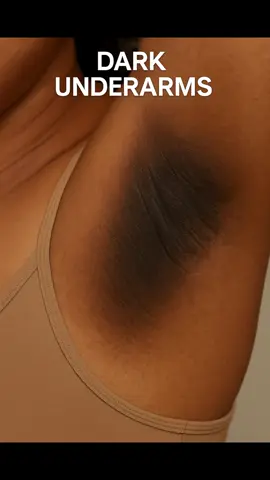 They’re packed with Kojic Acid, Glutathione, Collagen, Papaya, and Vitamin C that’s your brightening, smoothing, hydrating, and exfoliating dream team. #glowwithdapri #fyp #foryoupage #TikTokBeauty #BeautyTok #skincaretok #GlowUp #SelfCare #aesthetic #DarkSpots #AcneScars #Hyperpigmentation #DullSkin #DarkUnderarms #DarkElbows #Bacne #TexturedSkin #KojicAcid #Glutathione #CollagenSoap #VitaminCSoap #PapayaSoap #BrightAFSoap #HyperBrightAF #BrighteningSoap #GlowSoap #SoapThatWorks #SkincareForBaddies #BaddieGlow #BaddieApproved #GlowItLikeYouMeanIt #BodyCareThatSlaps #DapriGlow #GlowingSkinGoals  #MelaninMagic #SkinCareThatWorks