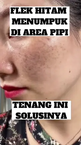 Sapu bersih flek menumpuk menahun