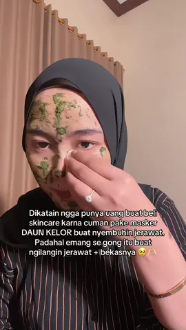 Padahal klo kalian mau baca, uda banyak loh articel international yang ngebahas kelor (Moringa oleifera) dengan segudang manfaatnya untuk kesehatan salah satunya bisa nyembuhin jerawat. Jadi jangan lagi kalian bilang aku ini buzzer kelor 😅😆 #acne #acnefighter #acnetreatment #scar #kelor #moringa #moringaoleifera #4u 