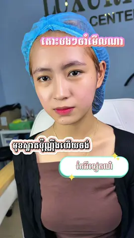 មើលពីជ្រុងណាក៏ស្អាតដែល🫣😍🥰 #filler #luxurybeauty #douyin #កែសម្ផស្ស #ចាក់បបូរមាត់ #ចាក់ច្រមុះ #ចាក់ចង្ការ #ស្បែកមុខស្អាត🥰 #botox 