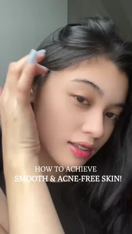 Glowing✨ Best serum for acne scars! 💕 @YOU Beauty Philippines  #skincare #peelingserum #recommendations #YOUBeautyPH #fyp 