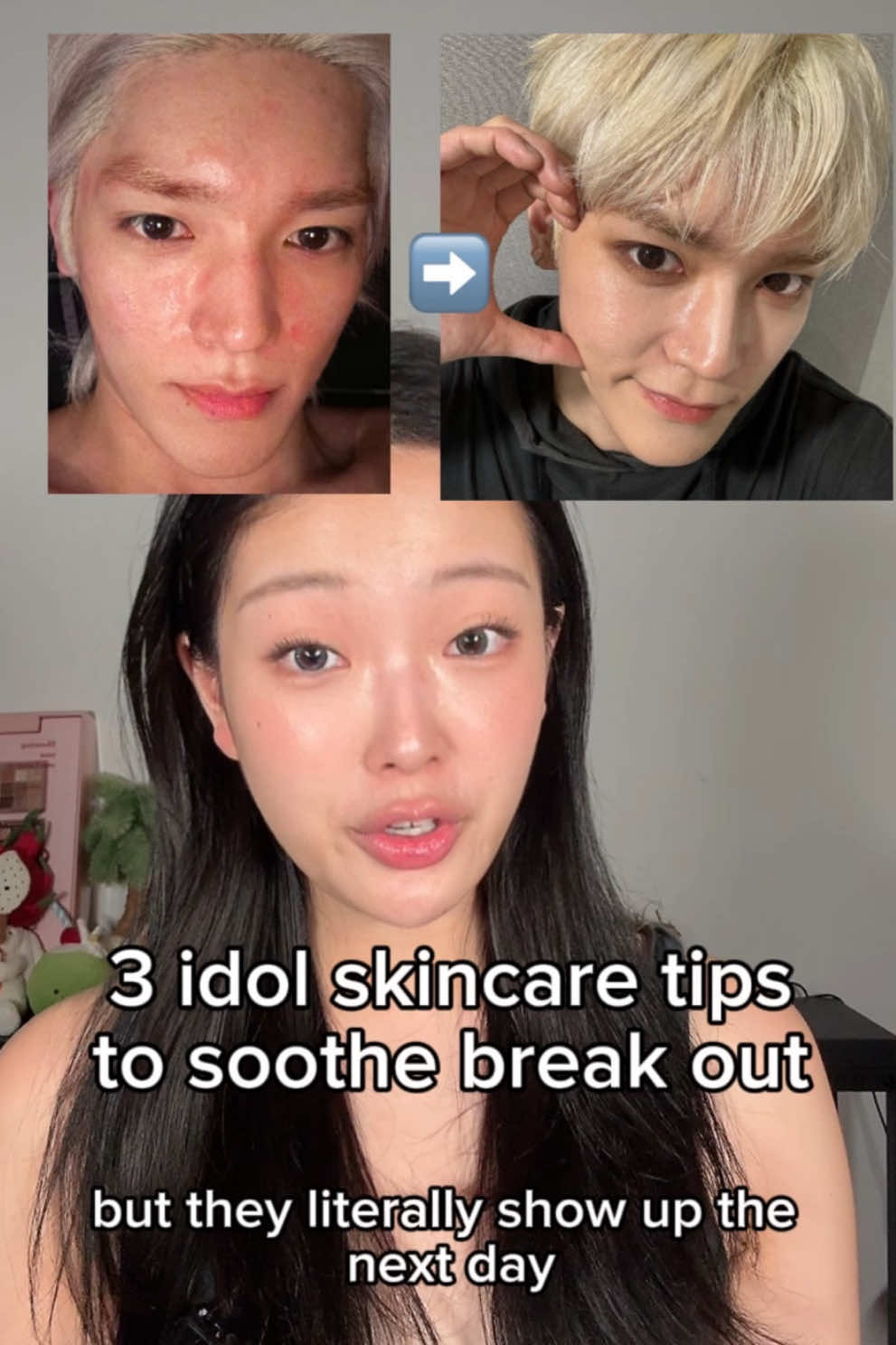 3 tips to soothe breakout fast!! #idolskincare #kbeauty #koreanskincare #idoldiet 