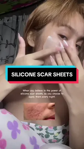 Transform your skin with silicone scar sheets #skincare #scarsheets #healtyskin #beautytips #fyp #creatorsearchinsights 