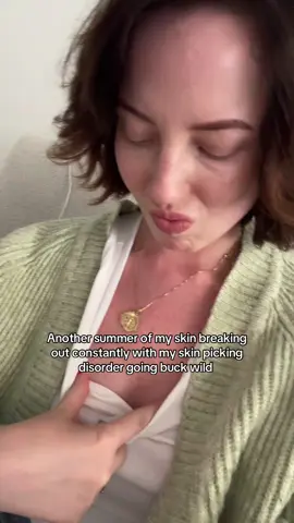 My skin is still ‘skinning’ 😒 #breakouts #summerskin #clearskin #clearskintips #skinpicking #dermatillomania #clearskinjourney 