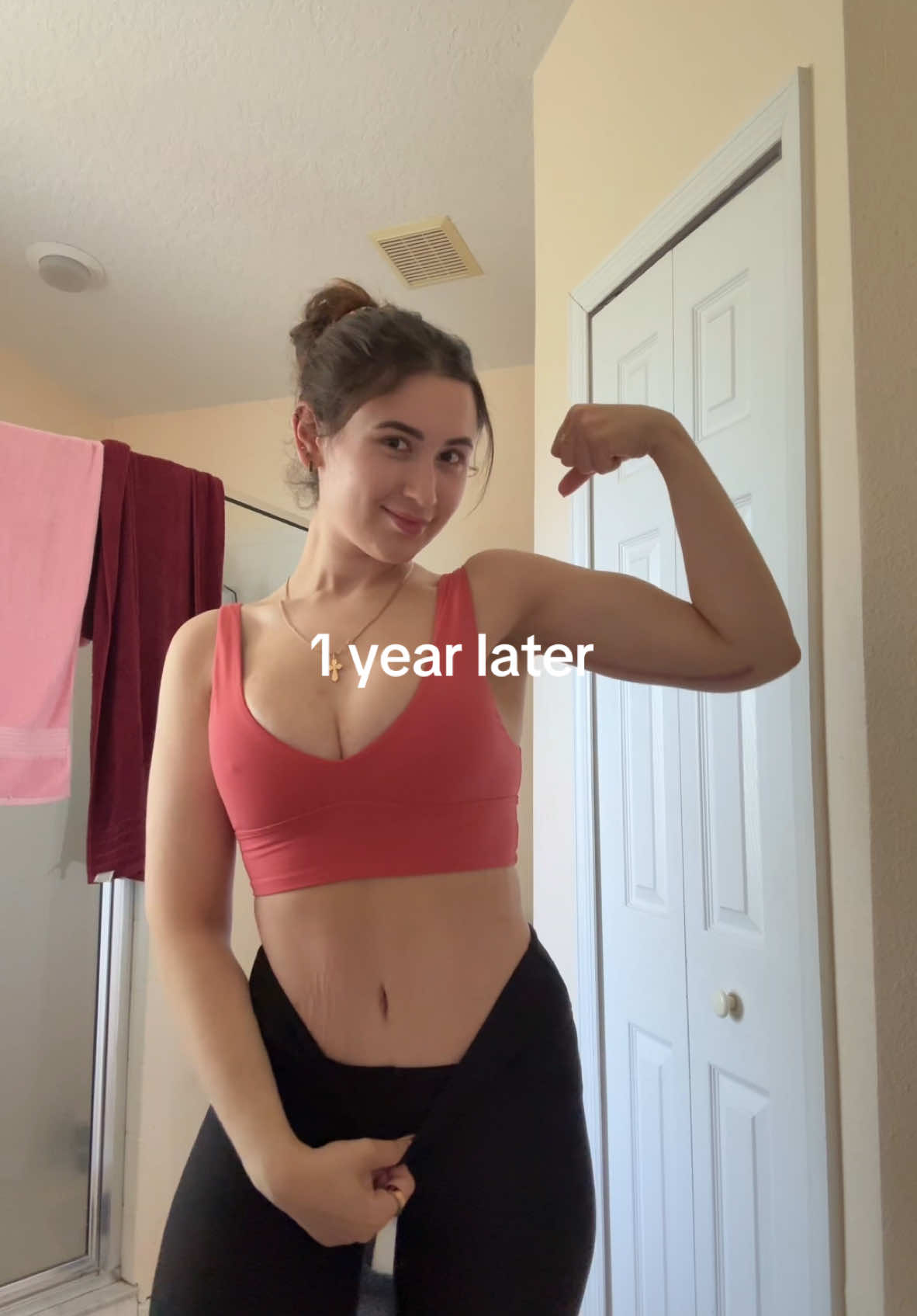 tomorrow is 1 year since my “mommy” makeover after losing over 100 lbs🥹 best decision ever!! Recovery was anything but easy but so worth it.  #tummytuck #armlift #brachioplasty #mommymakeover #skinremovalsurgery #looseskin #mommymakeoverjourney #abdominoplasty 