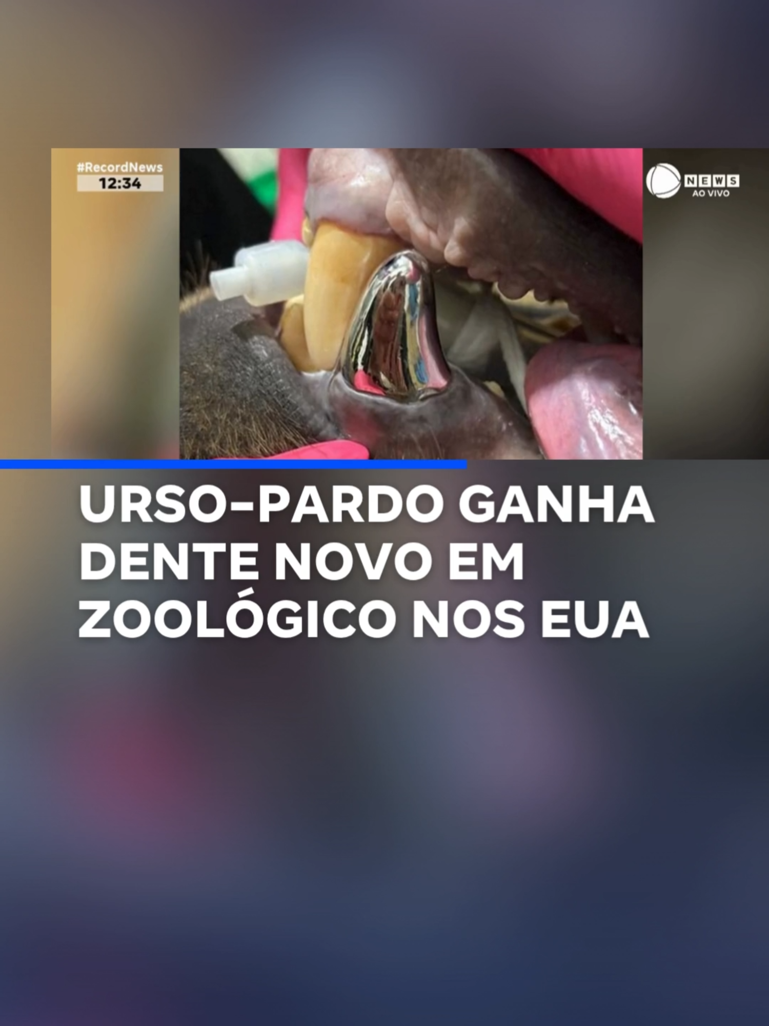 Um urso-pardo chamado Tundra, que vive em um zoológico nos Estados Unidos, recebeu um presente inusitado: um dente prateado. Com seis anos, mais de 360 quilos e quase três metros de altura, Tundra ganhou a maior coroa dentária já feita para um animal. O procedimento foi realizado por uma dentista veterinária especialista, após o urso apresentar vários problemas em um mesmo dente. A nova coroa foi feita sob medida e promete resistir até às mordidas mais fortes. 📲 #RecordNews