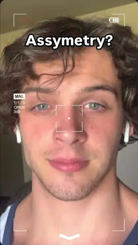 ⚙️ Key Habits to Build a More Symmetrical, Attractive Face: 👃 Nose Breathing & 👅 Tongue Posture Breathe through your nose at all times. Keep your tongue pressed firmly against the roof of your mouth (mewing). This expands the palate, supports the midface, and strengthens the jawline. 🥩 Chew Hard Foods Modern diets are too soft—bad for the jaw. Add in steak, raw veggies, nuts, or mastic gum to strengthen facial muscles and stimulate bone growth. 📏 Posture = Face Structure Fix forward head posture and rounded shoulders. Poor posture compresses the neck and jawline, throwing facial balance off. 🛏️ Sleep Position Matters Back sleeping is king for symmetry. ❌ Avoid side-sleeping—it compresses one side of the face over time. 🚫 Stop Asymmetrical Habits Chewing on one side, tilting your head, leaning on one hand—all lead to imbalance. Be mindful and correct them. 💆‍♂️ Myofunctional Exercises & Facial Massage Train facial muscles the same way you train your body. Simple exercises and daily facial massages improve tone, blood flow, and alignment. ✨ Skin = Surface-Level Symmetry Healthy, even-toned skin enhances perceived symmetry. Prioritize hydration 💧, nutrition 🥗, sunlight ☀️, and simple skincare. #looksmax #GlowUp #beforeandafter #mewing #symmetry 