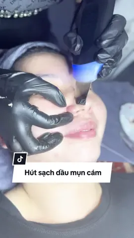 Hút sạch dầu mụn cám #daoataohocvienspa #takaspa #goidauduongsinh #massage #nghêspa 