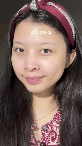 ga nyangka ternyata bisa ilang juga bekas jerawat🥰🥰 