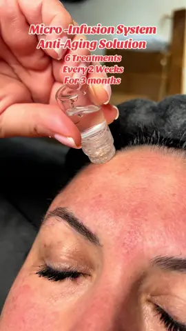 GRAB YOUR PACK BEFORE THEY RUN OUT! #fyne #fyneskincare #microneedling #skincare #antiaging #antiagingskincare #tiktokshop #tiktokshopfinds 