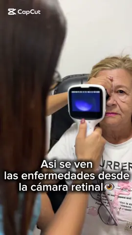 La cámara retinal nos permite detectar enfermedades en la retina de manera temprana y precisa. ¿Qué esperas para agendar tu cita con nosotros en @OpticaCristianDior y cuidar tu salud visual? #saludvisual #optometria #paratiiiiiiiiiiiiiiiiiiiiiiiiiiiiiii #colombia 